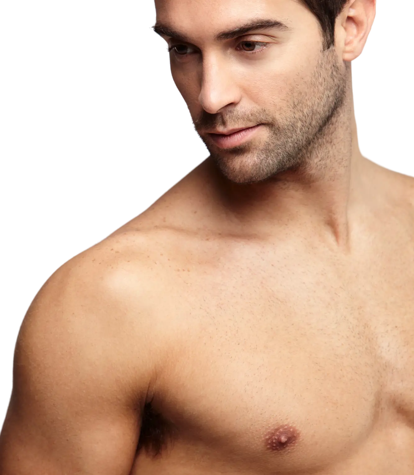 Financiar ginecomastia